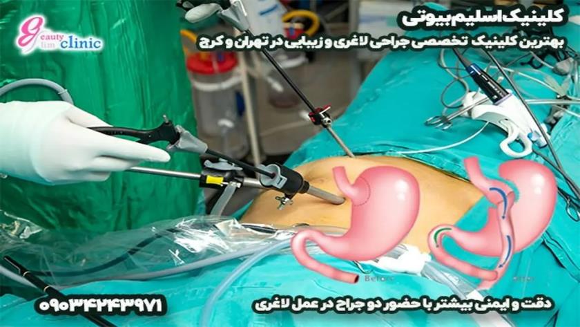 Iranpress: کلینیک اسلیم بیوتی؛ پیشرو در جراحی‌های لاغری و زیبایی
