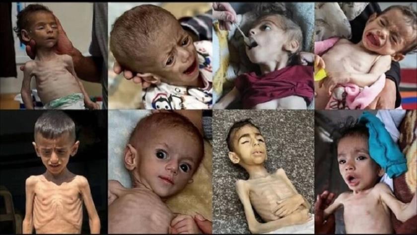 Iranpress: شهادت ۴۲۱ نفر در غزه طی سال ۲۰۲۵ به علت سوءتغذیه