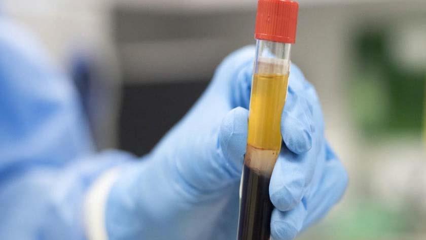 Iranpress: Plasma therapy treats 70% COVID-19 patients in Mashhad