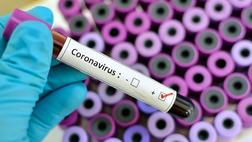 Iranpress: Global Covid-19 surpass 39.5 million