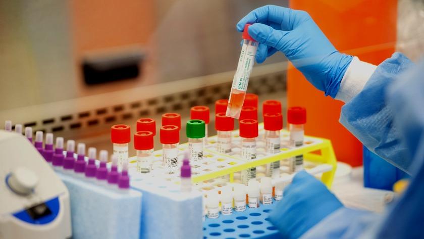 Iranpress: Iranian specialists produce RNA extraction kits