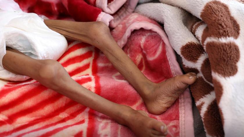 Iranpress: 80% of Yemeni people 