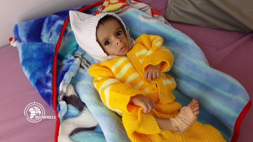 Iranpress: Poor condition of children in Al-Sabeen Hospital, Yemen