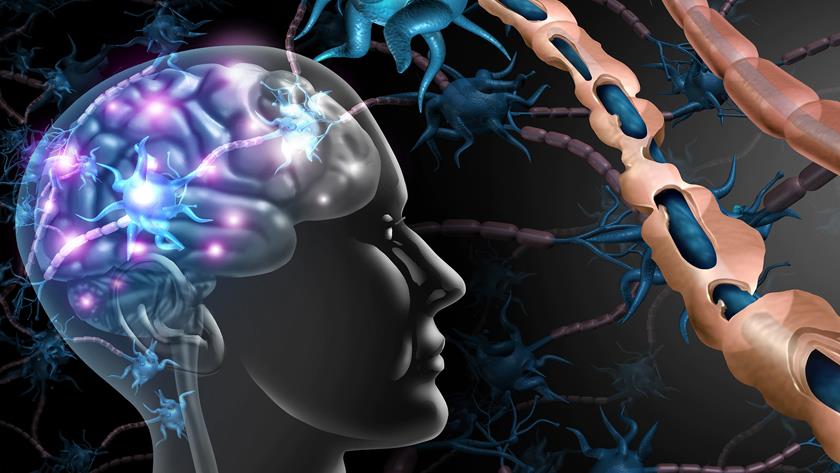 Iranpress: Interferon decreases risk for severe COVID-19 in MS patients