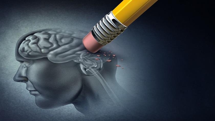 Iranpress: Low doses of radiation may improve quality of life for those with severe Alzheimer’s