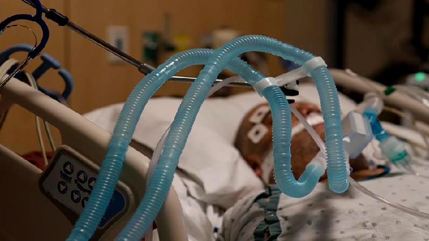 Iranpress: Severe COVID might make you 20 years older 
