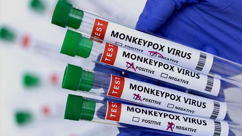 Iranpress: Monkeypox presents moderate risk to global public health