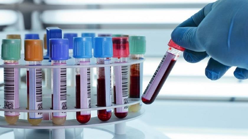 Iranpress: UK: Number of people with monkeypox jumps to 470