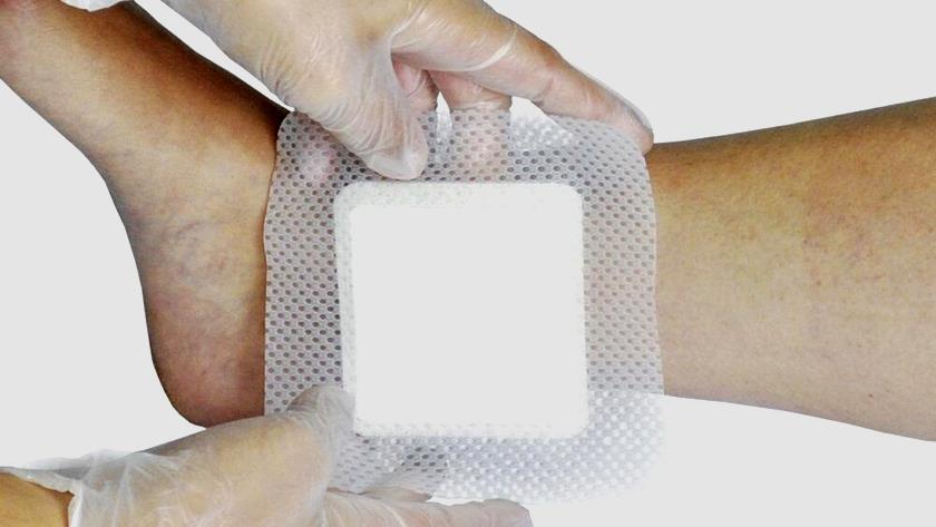 Iranpress: Iran-made nano wound dressing can evaluate wounds  