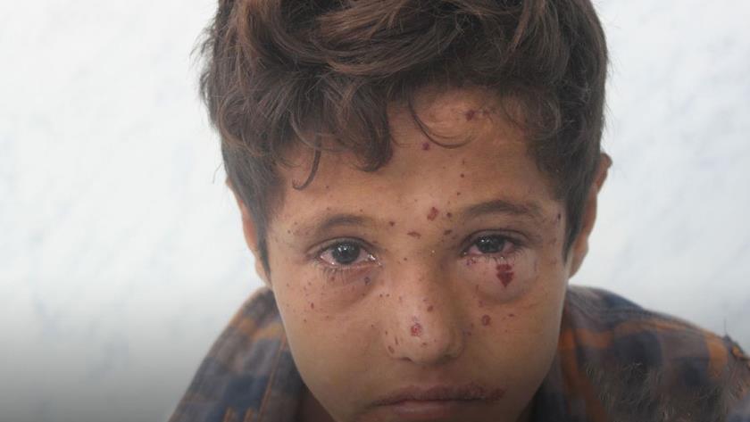 Iranpress: 3 civilians injured in mine explosion in Yemen