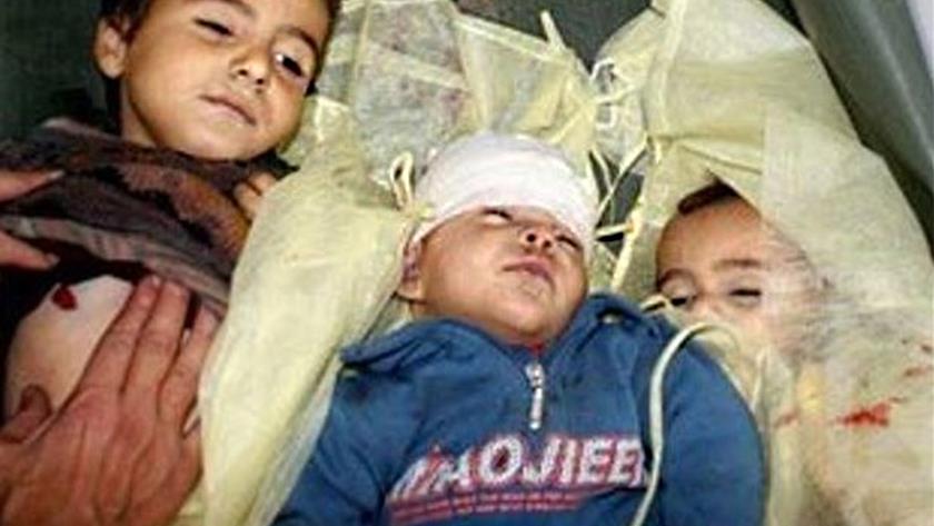 Iranpress: Zionists attack leave 3000 Palestinian children martyred