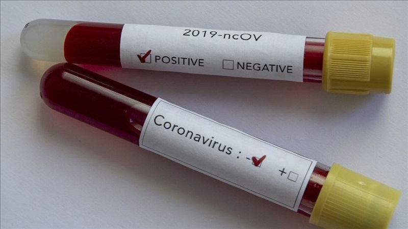 Iranpress: Le coronavirus tue au moins 1,3 et infecte jusqu
